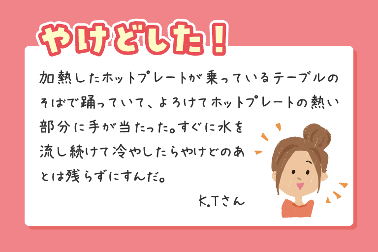 加熱したホットプレートが乗っているテーブルのそばで踊っていて、よろけてホットプレートの熱い部分に手が当たった。すぐに水を流し続けて冷やしたらやけどのあとは残らずにすんだ。K.Tさん
